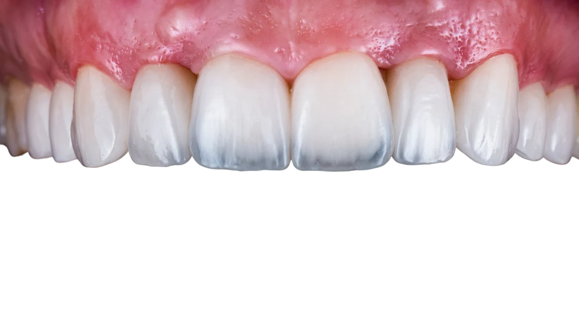 Dentists learning together during a MAG Dental Academy course